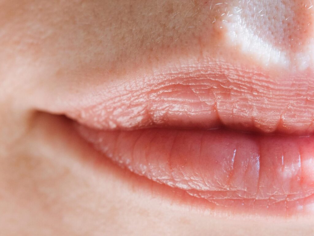 SonderBeaut rosy lips