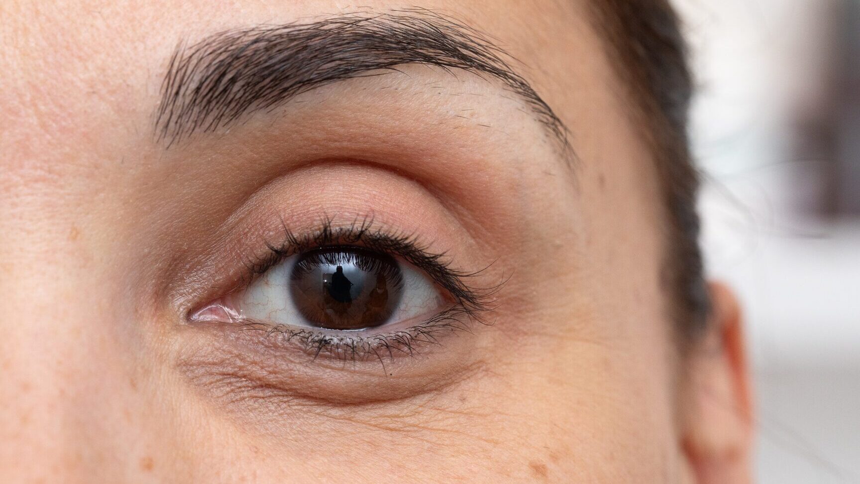 SonderBeaut dark under eye circles