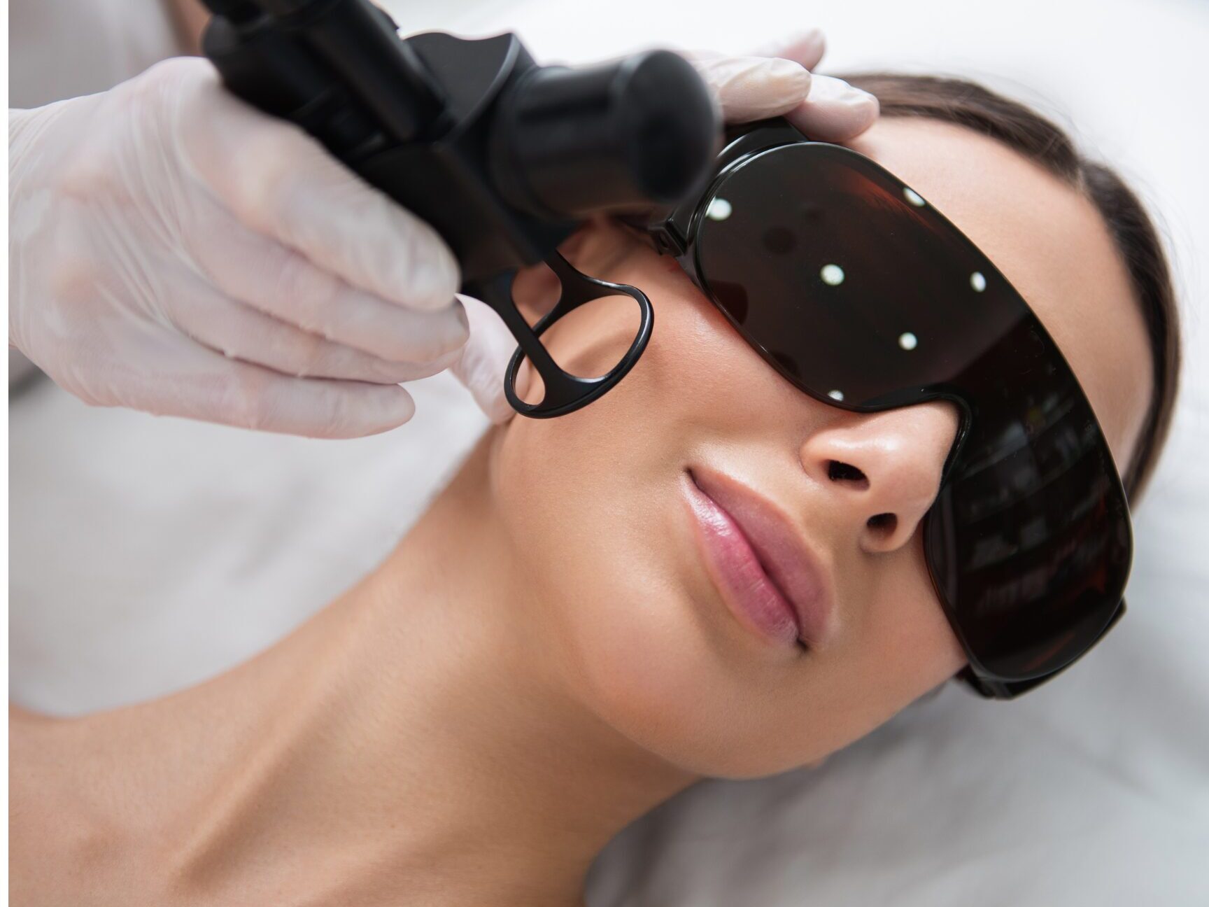 SonderBeaut laser being used on skin