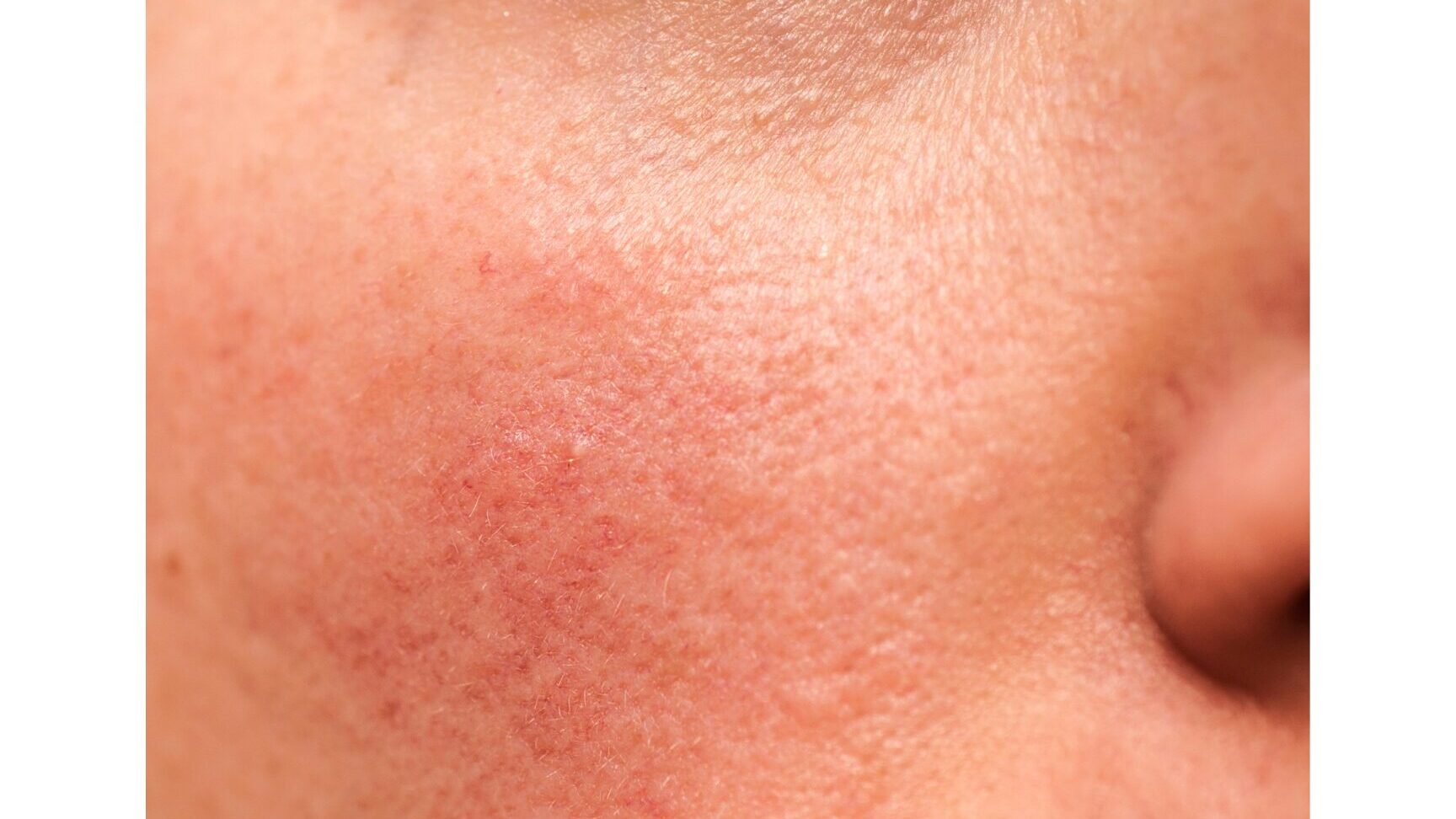 textured skin