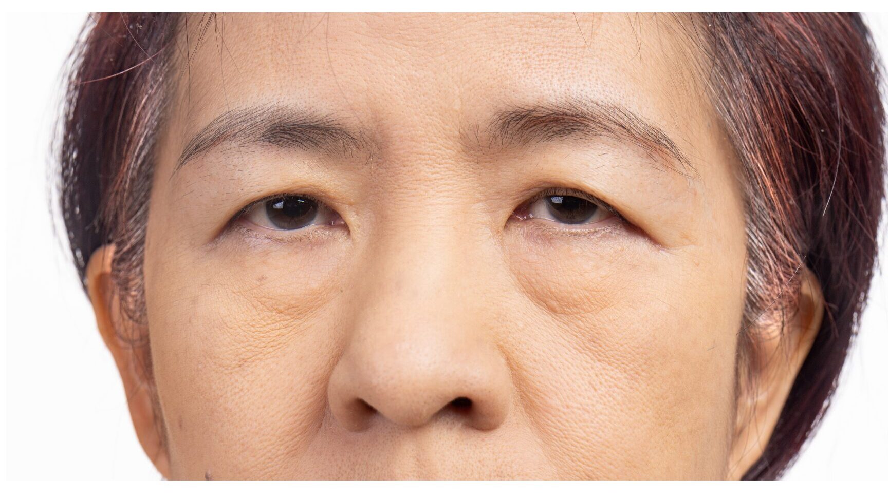 hooded eyes