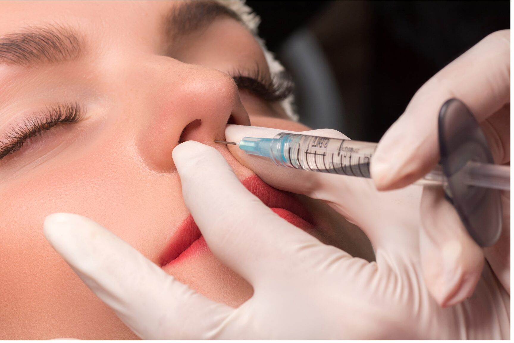 SonderBeaut woman getting nose injections