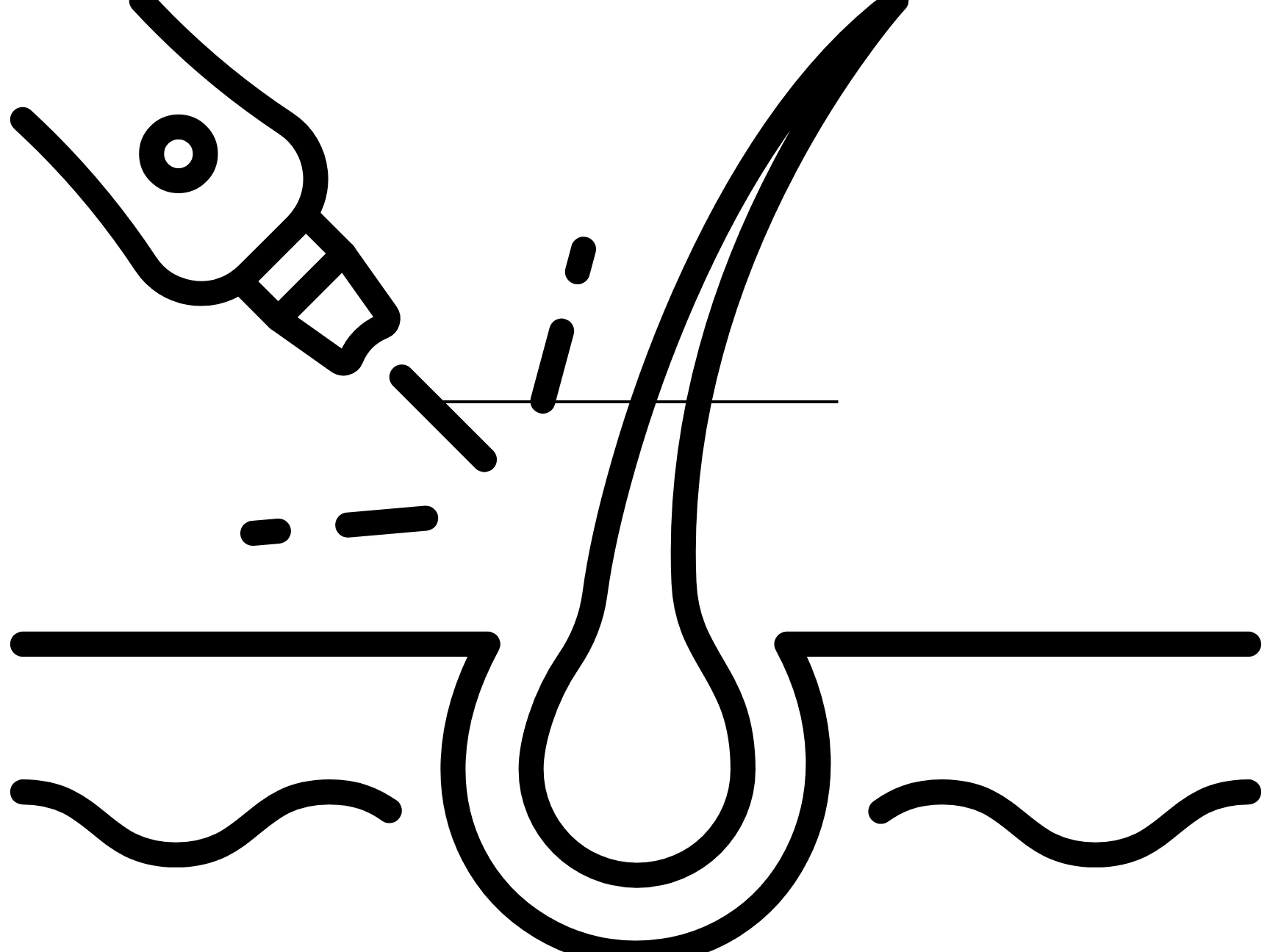 animated visual of follicle being zapped by laser